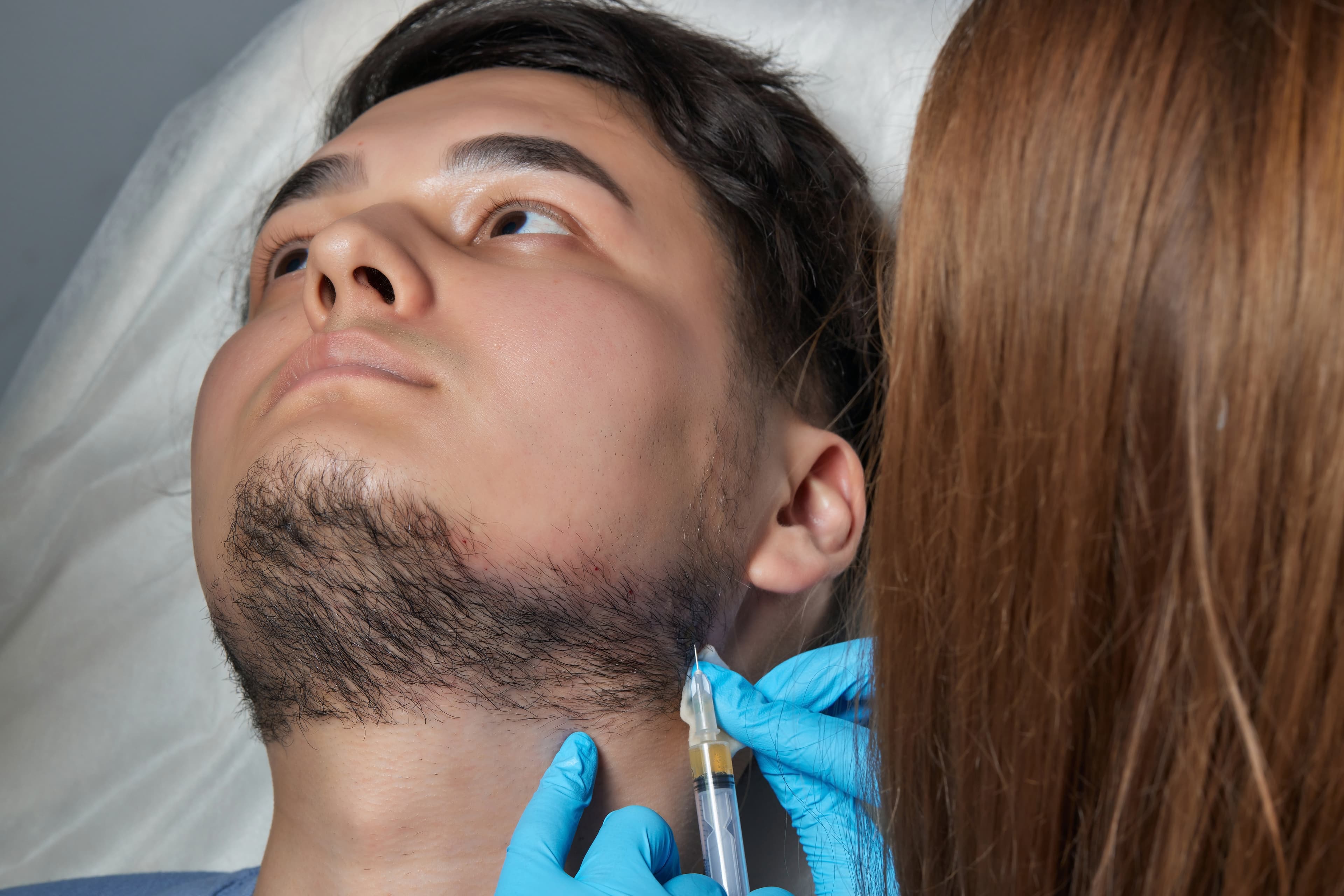 Beard Transplant