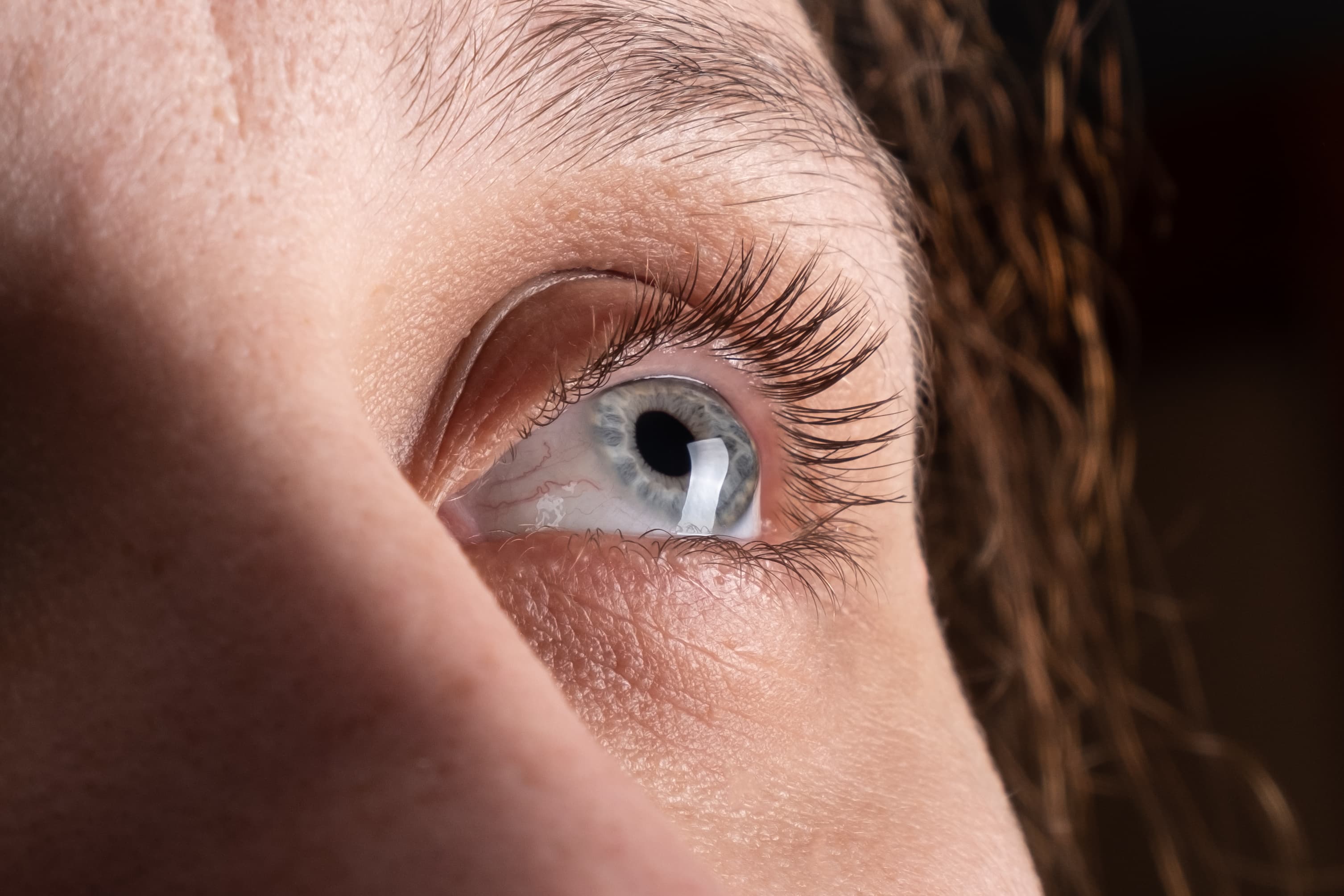 Eyebrow Transplant
