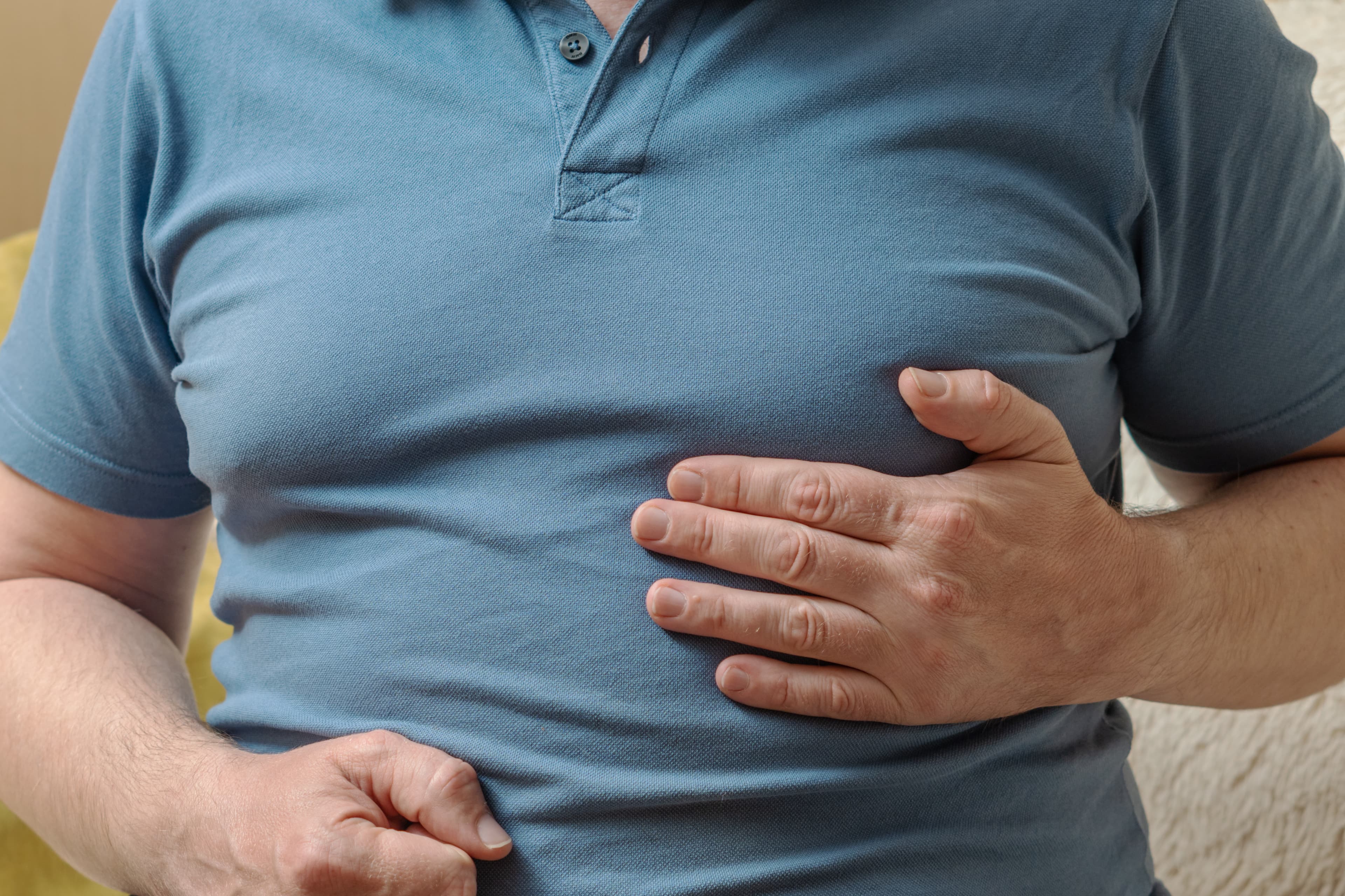 Gynecomastia Surgery
