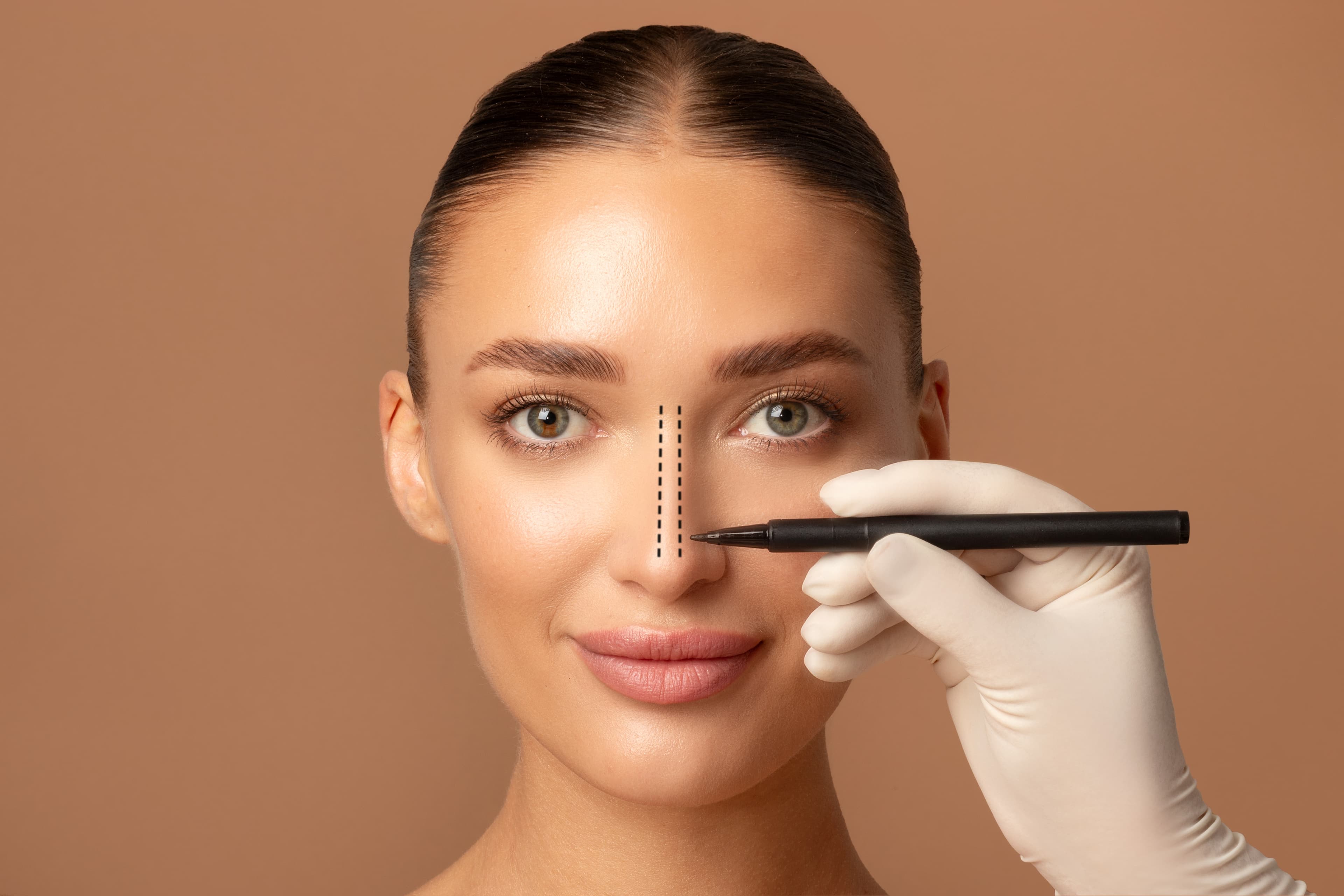 Rhinoplasty